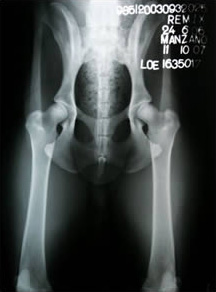 Ch. Remix de Pomerland - Caderas