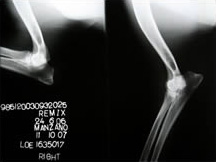 Ch. Remix de Pomerland - Codo Derecho